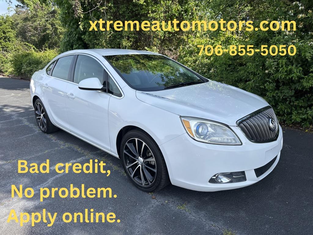 2017 Buick Verano 1SH